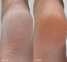 Load image into Gallery viewer, FHF Enrich Mint Foot Rescue Mask