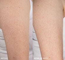 Load image into Gallery viewer, FHF Smooth Reveal Resurfacing Serum
