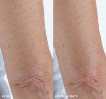 Load image into Gallery viewer, FHF Smooth Reveal Resurfacing Serum