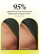 Load image into Gallery viewer, Fur Ingrown Eliminator Serum Rollerball!