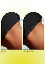 Load image into Gallery viewer, Fur Ingrown Eliminator Serum